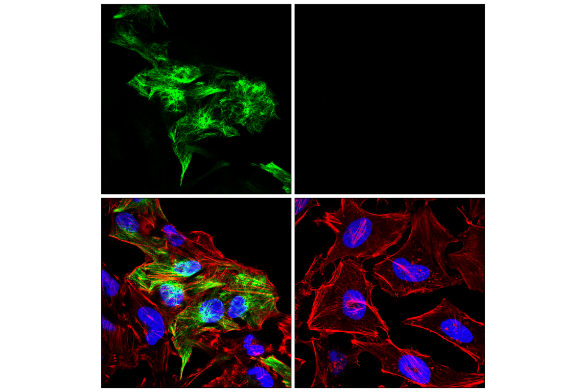 Immunofluorescence Image 1: GFAP (E4L7M) Rabbit Monoclonal Antibody (BSA and Azide Free)