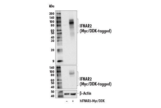 Western Blotting Image 2: IFNAR2 (E7Z4M) Rabbit Monoclonal Antibody