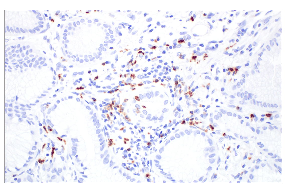 Immunohistochemistry Image 3: NKG7 (F4V5I) Rabbit Monoclonal Antibody
