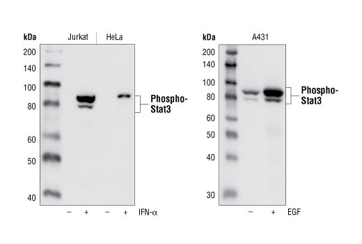 Western Blotting Image 1: Phospho-Stat3 (Tyr705) (D3A7) XP<sup>®</sup> Rabbit mAb (BSA and Azide Free)