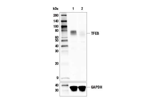Western Blotting Image 2: TFEB (E5P9M) Rabbit Monoclonal Antibody