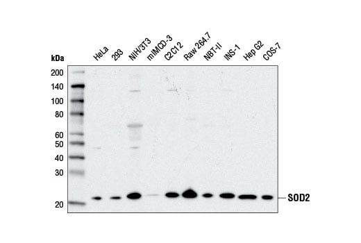 Western Blotting Image 1: SOD2 (D9V9C) Rabbit mAb