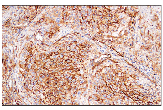Immunohistochemistry Image 2: CD141/Thrombomodulin (E7Y9P) Rabbit Monoclonal Antibody
