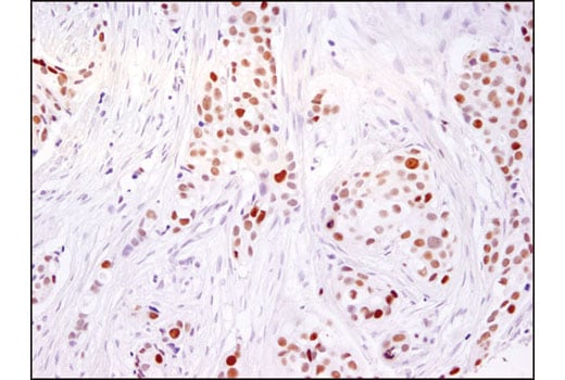 Immunohistochemistry Image 1: Ezh2 (D2C9) Rabbit Monoclonal Antibody (BSA and Azide Free)