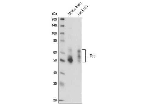 Western Blotting Image 2: Tau (Tau46) Mouse Monoclonal Antibody (BSA and Azide Free)