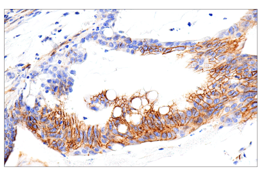 Immunohistochemistry Image 3: CD99 (PCB1) Mouse Monoclonal Antibody