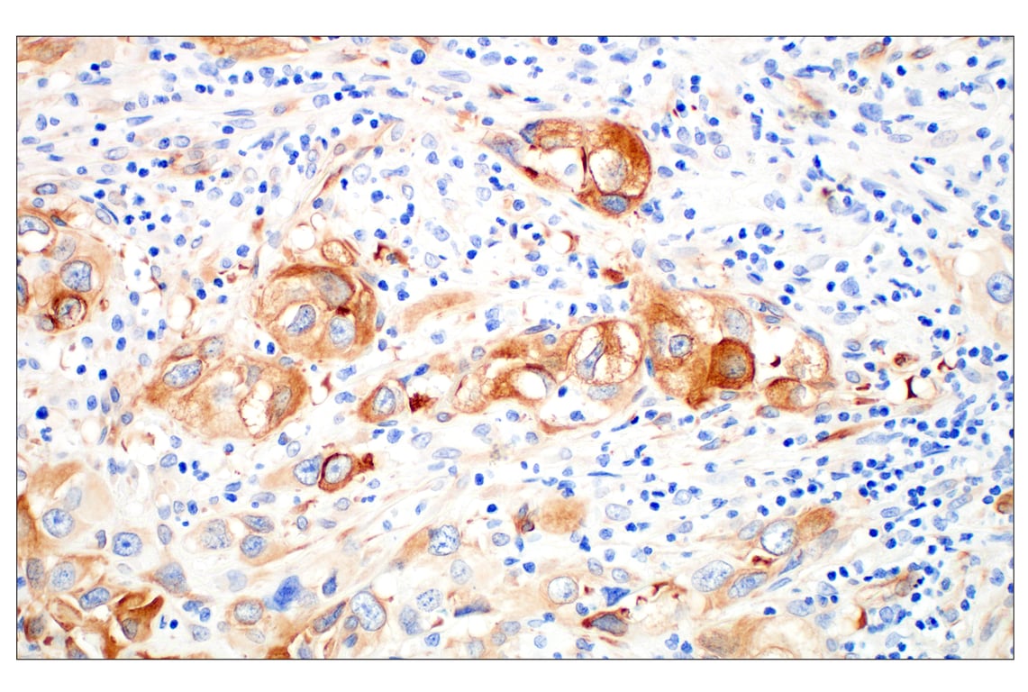 Immunohistochemistry Image 7: beta3-Tubulin (E9F3E) Mouse Monoclonal Antibody (BSA and Azide Free)