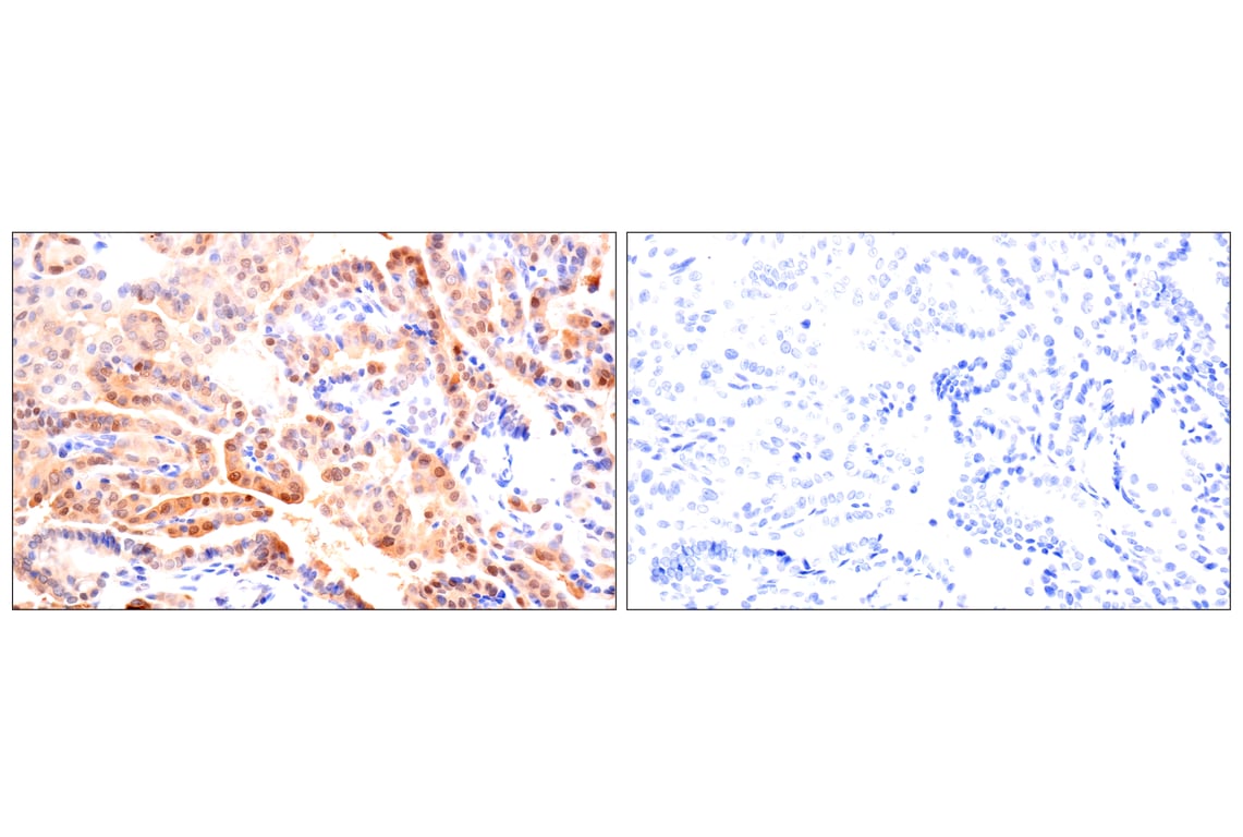 Immunohistochemistry Image 12: ACBP/DBI (E6K8G) Rabbit Monoclonal Antibody