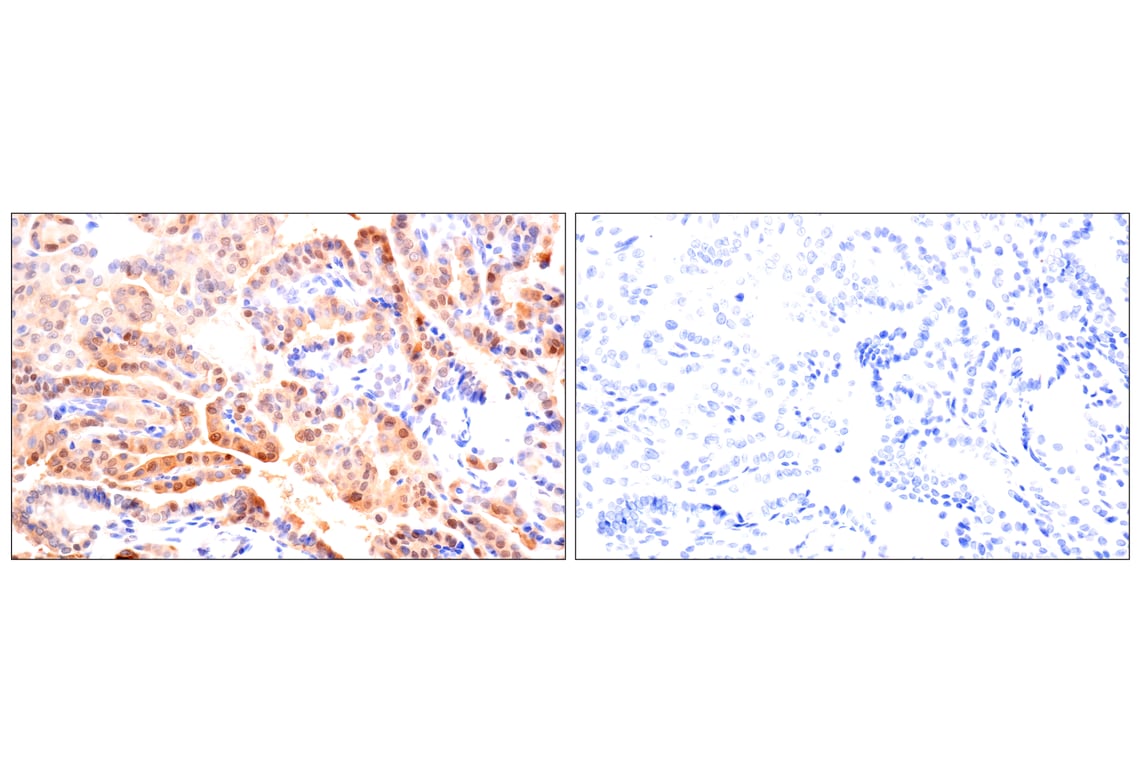 Immunohistochemistry Image 12: ACBP/DBI (E6K8G) XP<sup>®</sup> Rabbit mAb