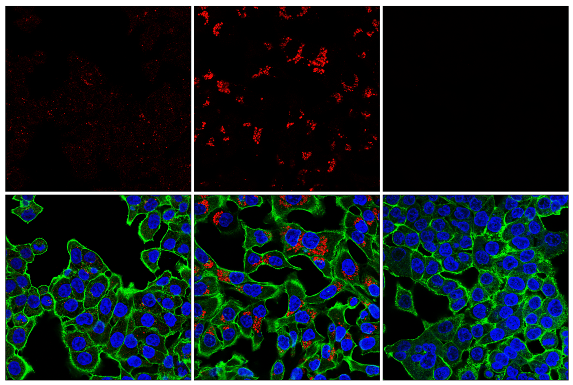 Immunofluorescence Image 2: LC3B (E5Q2K) Mouse Monoclonal Antibody (Alexa Fluor<sup>®</sup> 647 Conjugate)