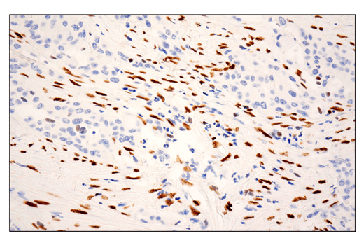 Immunohistochemistry Image 1: ZEB1 (E2G6Y) Rabbit Monoclonal Antibody (BSA and Azide Free)