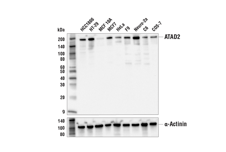 Western Blotting Image 1: ATAD2 (E8Y7F) Rabbit mAb