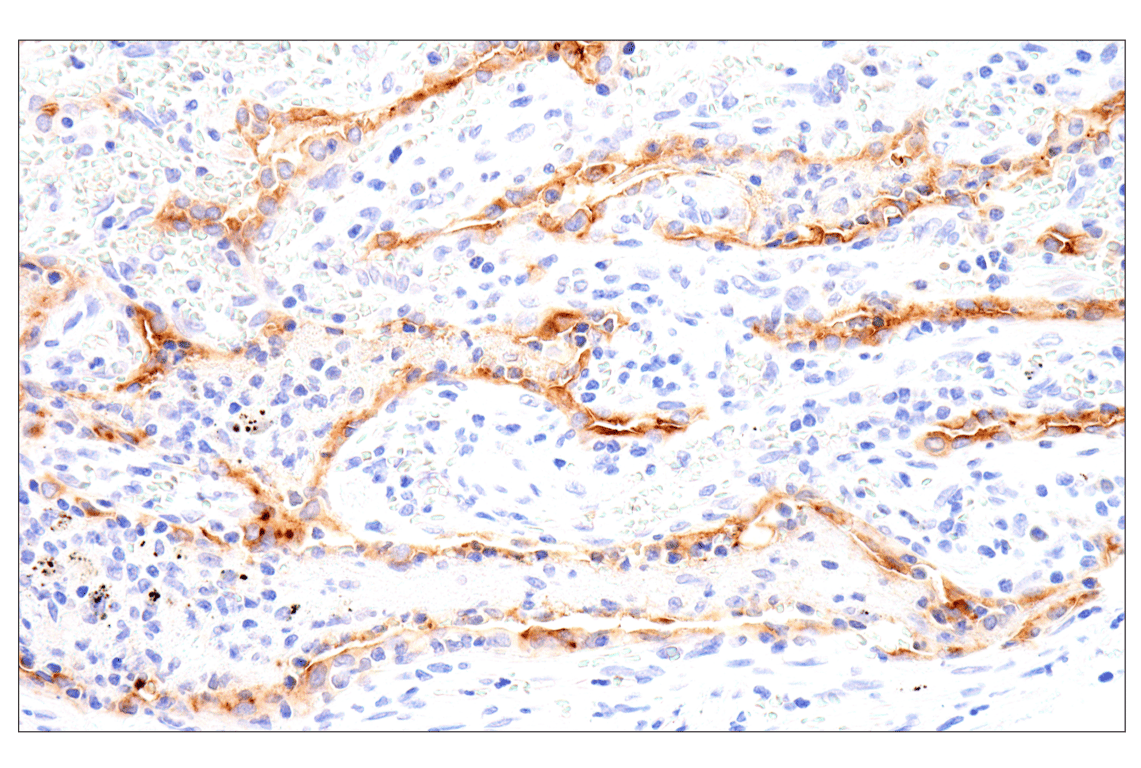Immunohistochemistry Image 1: Folate Receptor Alpha/FOLR1 (BN3.2) Mouse Monoclonal Antibody