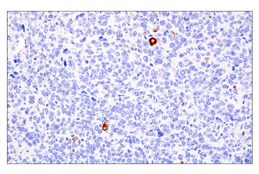 Immunohistochemistry Image 2: 4-1BB/CD137/TNFRSF9 (E2J5H) Rabbit Monoclonal Antibody