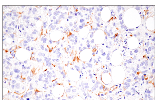 Immunohistochemistry Image 1: CTHRC1 (E8M9S) Rabbit Monoclonal Antibody