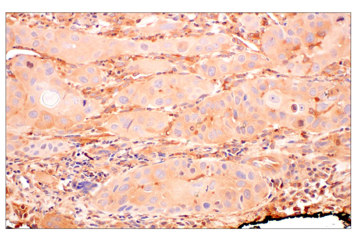 Immunohistochemistry Image 3: ILK1 (4G9) Rabbit Monoclonal Antibody (BSA and Azide Free)