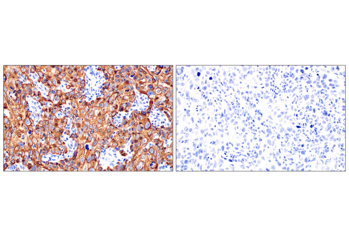 Immunohistochemistry Image 9: Keratin 14 (E7W6V) Rabbit Monoclonal Antibody