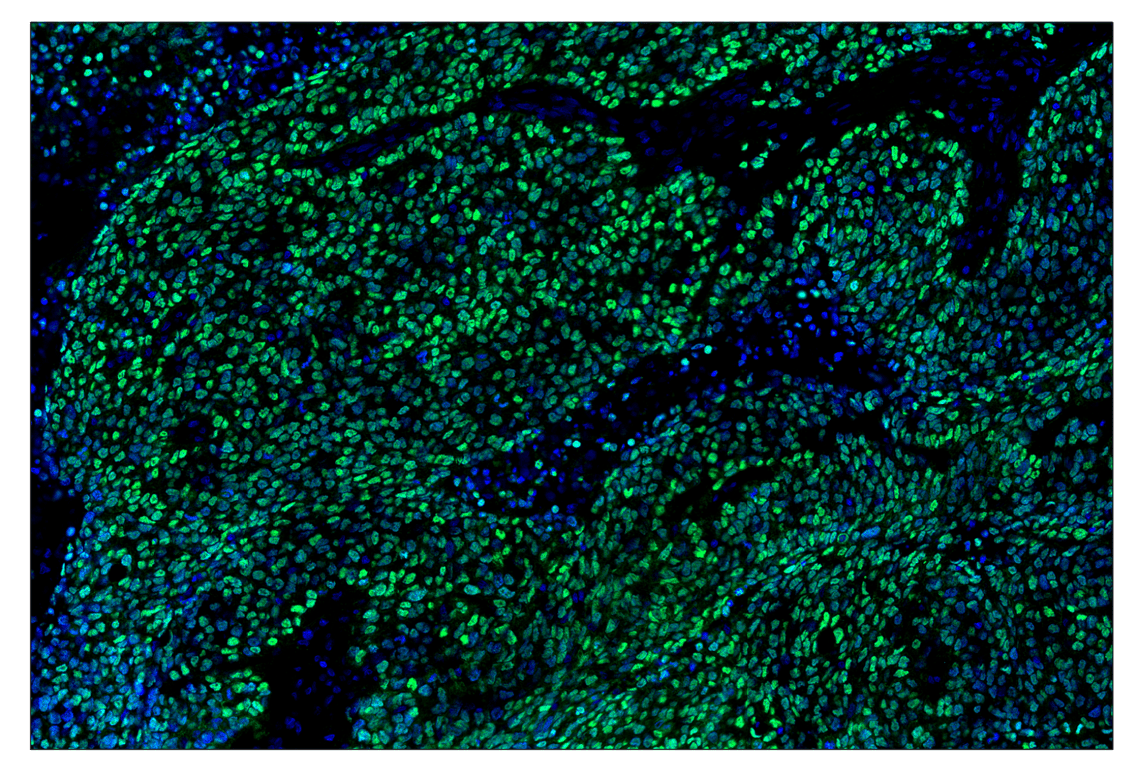Immunohistochemistry Image 1: p63 (D9L7L) & CO-0161-750 SignalStar<sup>™</sup> Oligo-Antibody Pair
