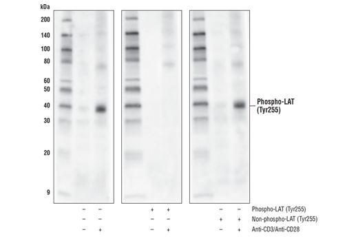 Western Blotting Image 2: Phospho-LAT (Tyr255) Antibody