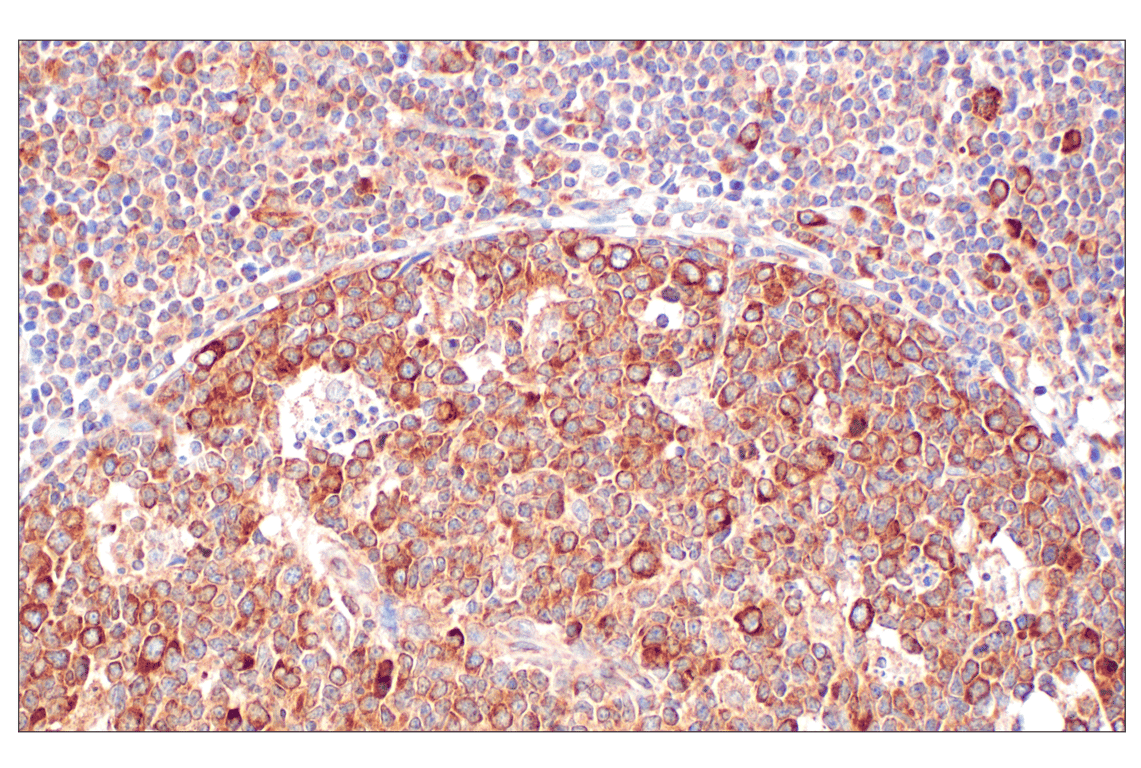 Immunohistochemistry Image 4: PABP1 (F6G6L) Rabbit Monoclonal Antibody