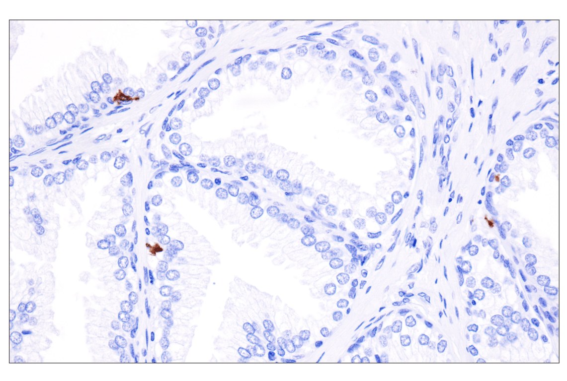 Immunohistochemistry Image 5: Langerin (F8L8I) Rabbit Monoclonal Antibody