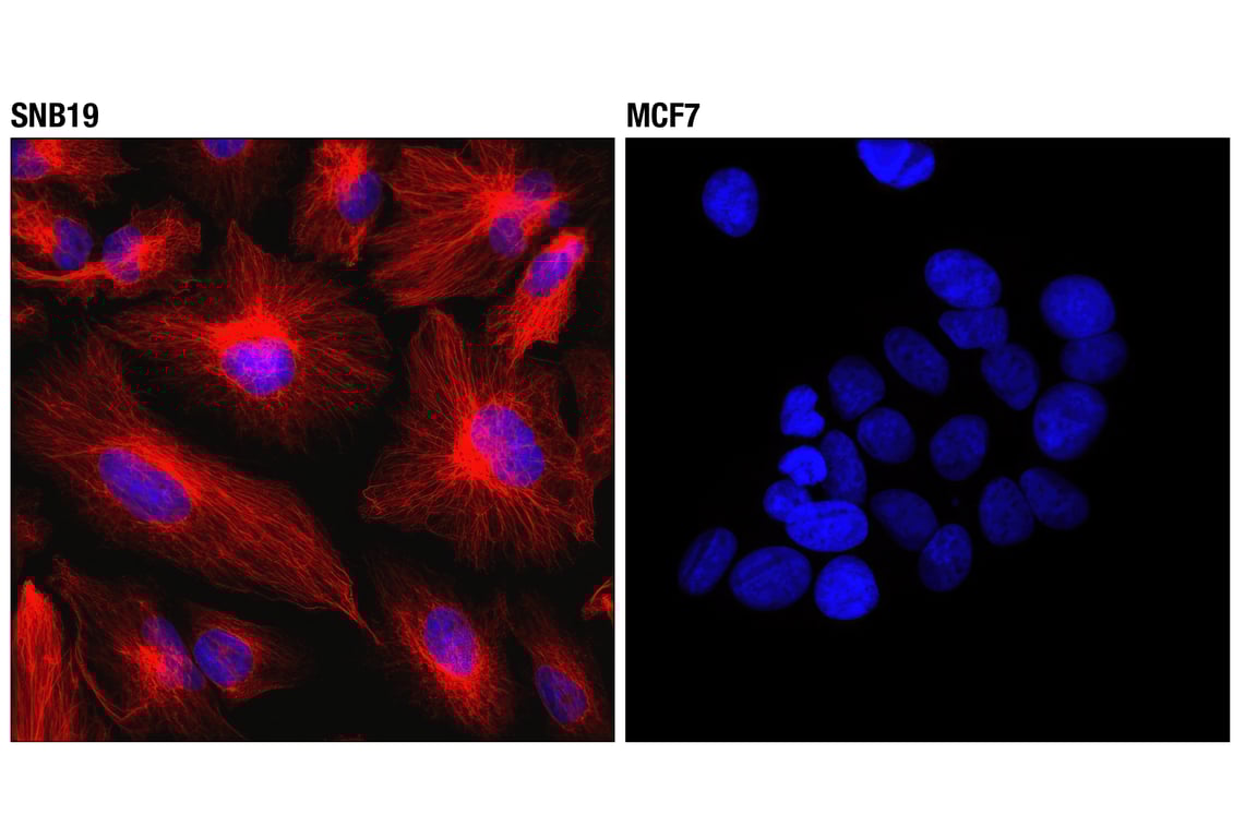 Immunofluorescence Image 1: Vimentin (D21H3) Rabbit Monoclonal Antibody (Alexa Fluor<sup>®</sup> 555 Conjugate)