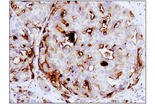 Immunohistochemistry Image 1: B7-H4 (D1M8I) Rabbit Monoclonal Antibody