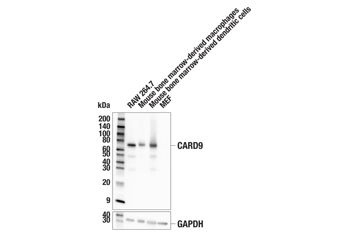 Western Blotting Image 1: CARD9 (E4N1E) Rabbit mAb