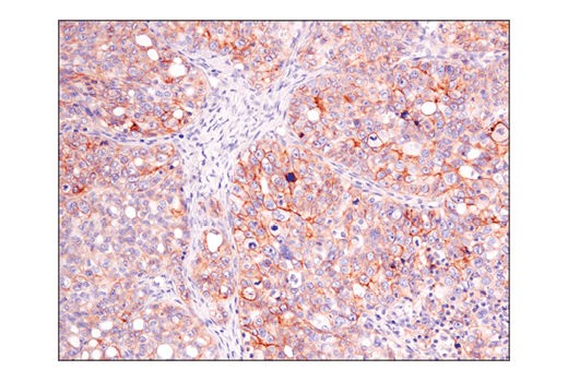 Immunohistochemistry Image 6: ASCT2 (D7C12) Rabbit Monoclonal Antibody