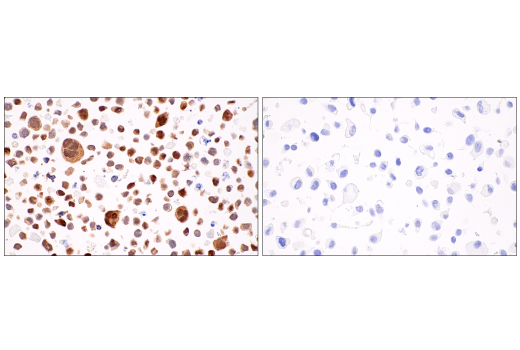 Immunohistochemistry Image 10: Parvalbumin (E8N2U) Rabbit Monoclonal Antibody (BSA and Azide Free)