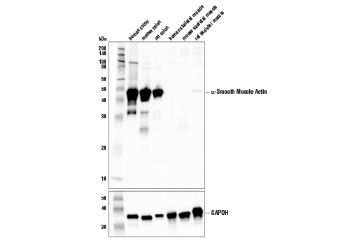 Western Blotting Image 1: alpha-Smooth Muscle Actin (1A4) Mouse Monoclonal Antibody (BSA and Azide Free)