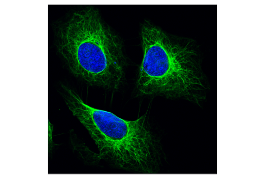 Immunofluorescence Image 1: Pan-Keratin (C11) Mouse Monoclonal Antibody (BSA and Azide Free)