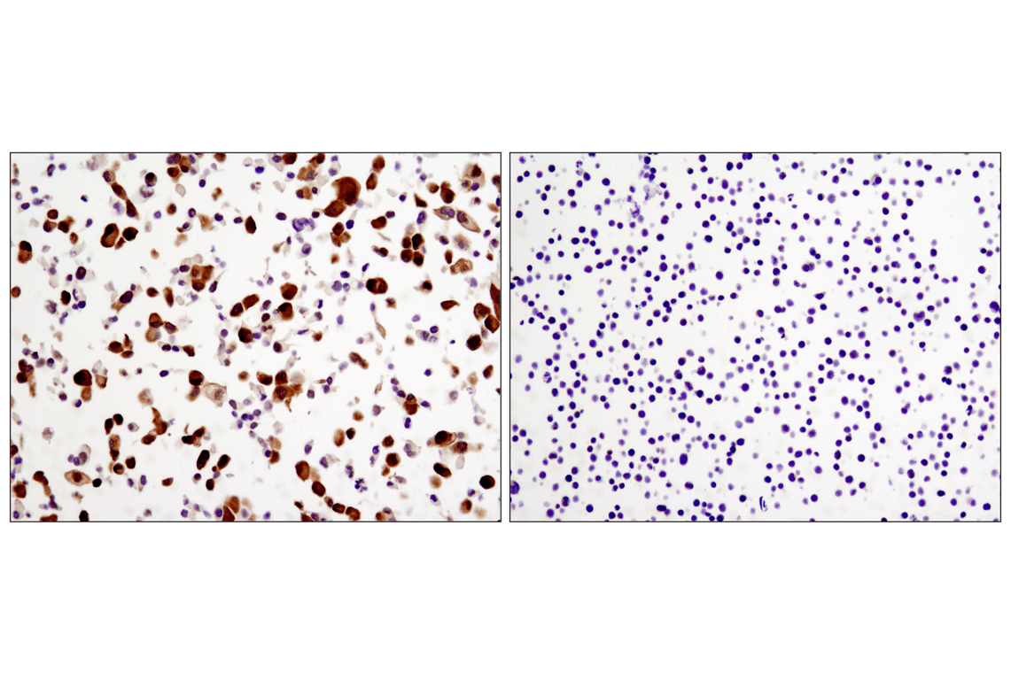 Immunohistochemistry Image 3: YAP (1A12) Mouse Monoclonal Antibody (BSA and Azide Free)