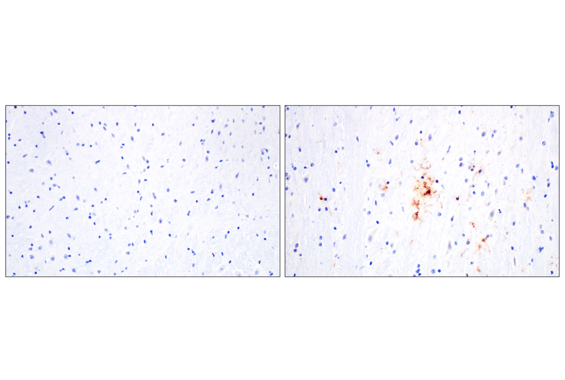 Immunohistochemistry Image 3: DAP12 (F1Q2P) Rabbit Monoclonal Antibody