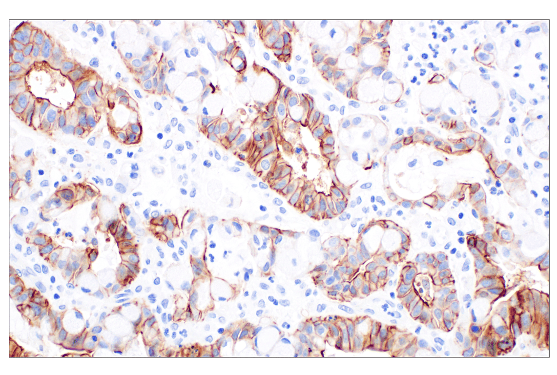 Immunohistochemistry Image 5: CD44 v5 (C44Mab-3) Mouse Monoclonal Antibody
