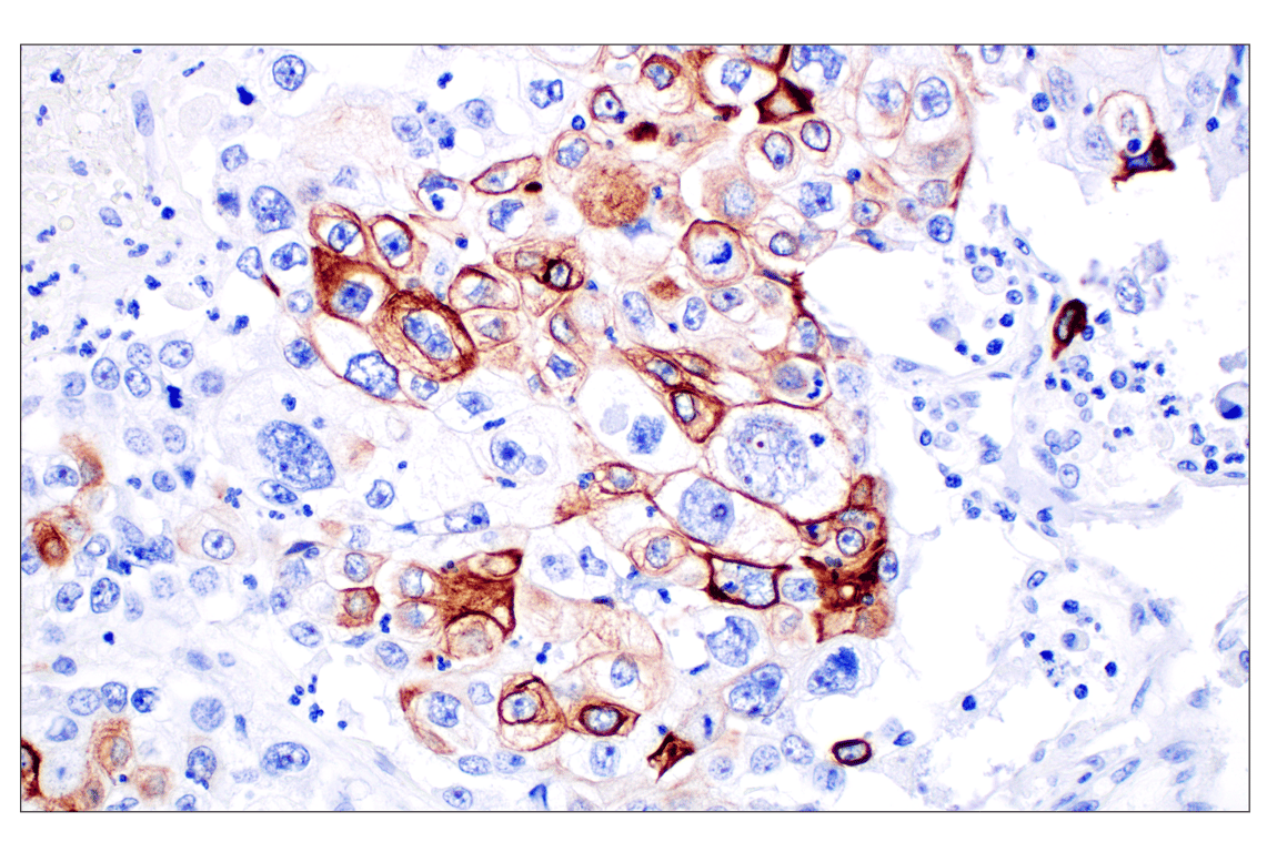Immunohistochemistry Image 3: Keratin 14 (E7W6V) Rabbit Monoclonal Antibody (BSA and Azide Free)