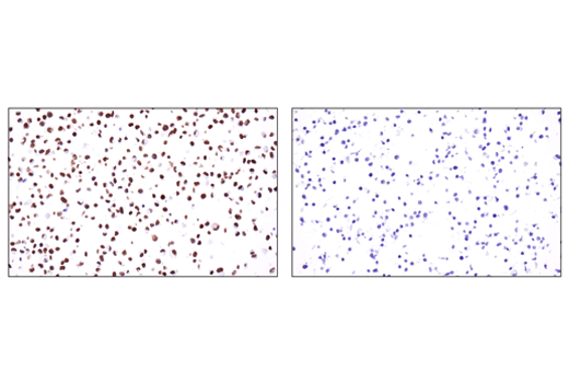 Immunohistochemistry Image 7: ZEB1 (E2G6Y) XP<sup>®</sup> Rabbit mAb (BSA and Azide Free)