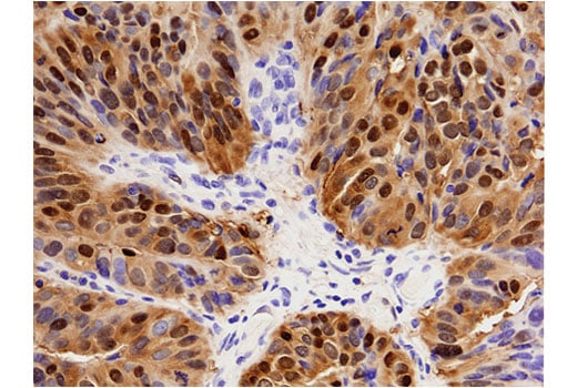Immunohistochemistry Image 2: Annexin A1 (D5V2T) Rabbit Monoclonal Antibody