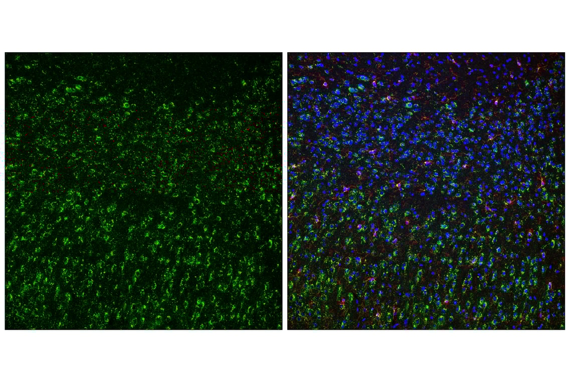 undefined Image 17: Genetics of Parkinson's Disease: Lysosomal Dysfunction Antibody Sampler Kit