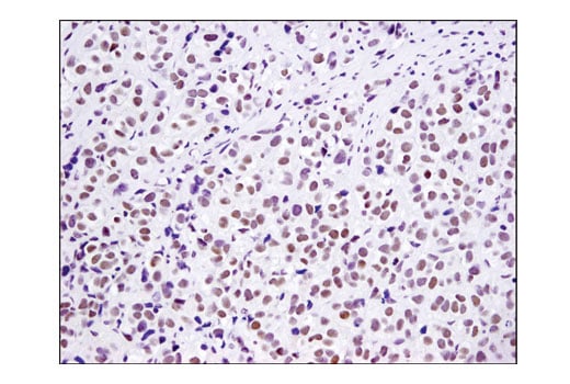 Immunohistochemistry Image 1: UTX (D3Q1I) Rabbit Monoclonal Antibody