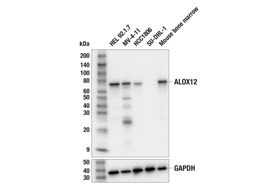 Western Blotting Image 1: ALOX12 (E3O9P) Rabbit mAb