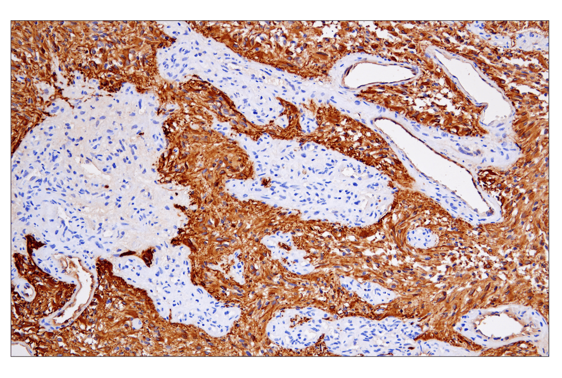 Immunohistochemistry Image 2: GFAP (E4L7M) XP<sup>®</sup> Rabbit mAb (BSA and Azide Free)