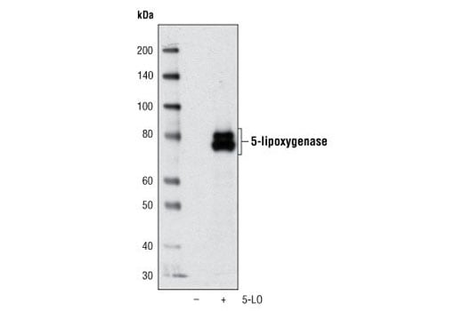 Western Blotting Image 2: 5-Lipoxygenase (C49G1) Rabbit Monoclonal Antibody