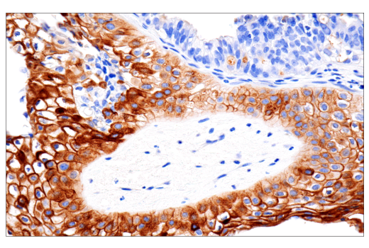 Immunohistochemistry Image 1: CD109 (E4I2V) Rabbit Monoclonal Antibody