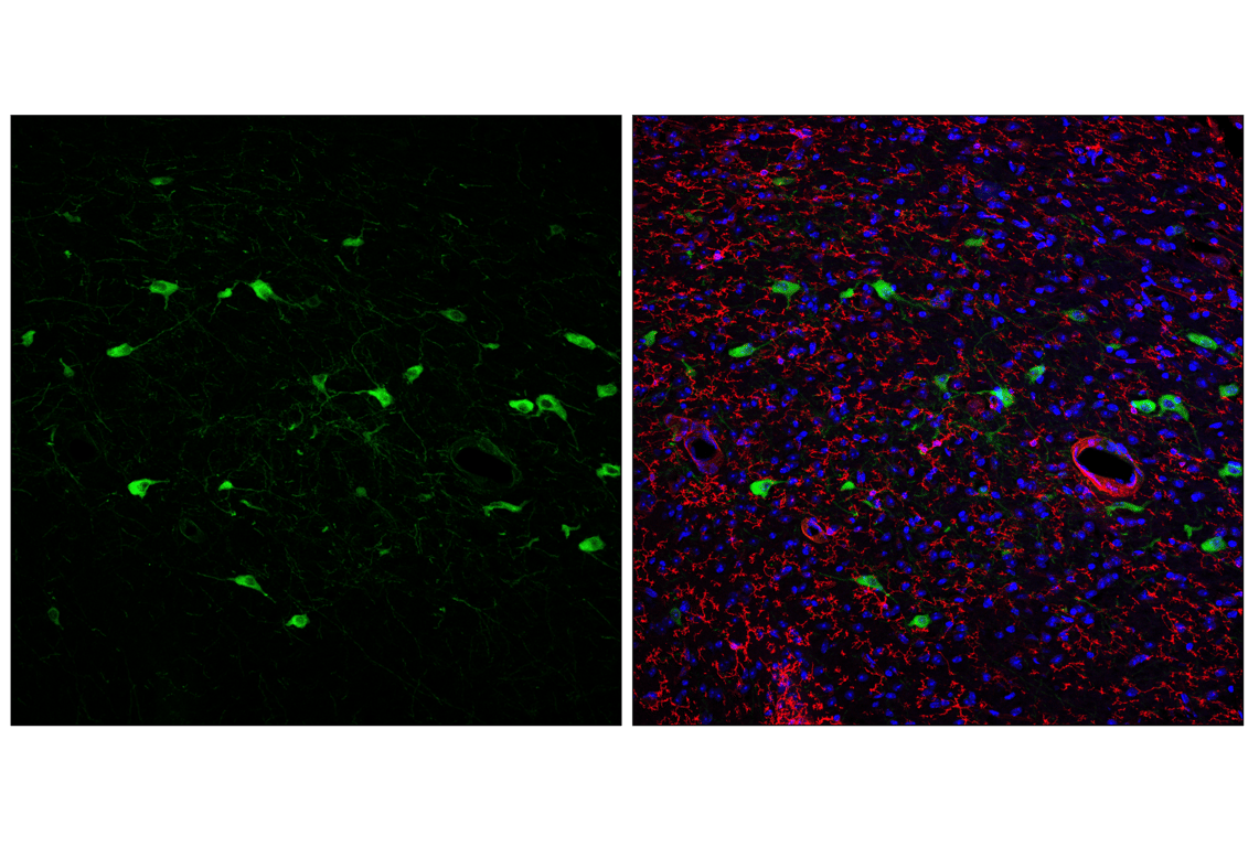 Immunofluorescence Image 1: p75NTR (F2L9S) Rabbit Monoclonal Antibody