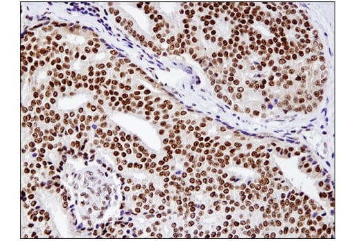 Immunohistochemistry Image 1: BRM (D9E8B) Rabbit Monoclonal Antibody (BSA and Azide Free)