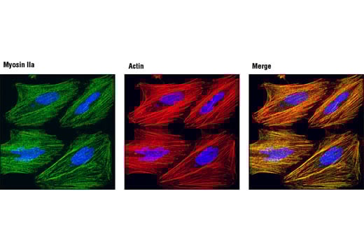 Immunofluorescence Image 1: Myosin IIa Antibody
