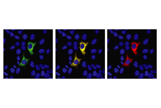 Immunofluorescence Image 1: FnCpf1/Cas12a (Strain <i>U112</i>) (E7I2B) Rabbit Monoclonal Antibody