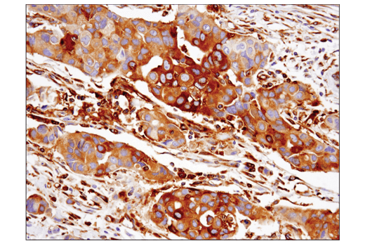 Immunohistochemistry Image 1: IFIT1 (D2X9Z) Rabbit Monoclonal Antibody