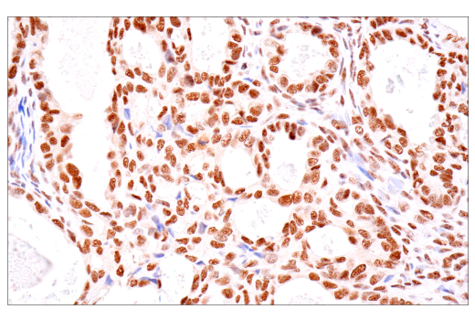 Immunohistochemistry Image 9: TDP43 (E2G6G) Rabbit Monoclonal Antibody